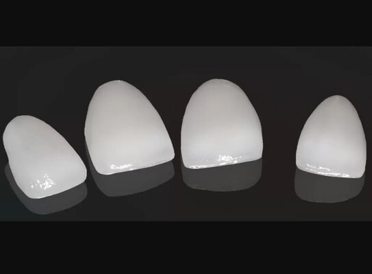 কেনা উচ্চ নান্দনিকতা কম্পোজিট ক্রাউন অনলে ভিনিয়ার কাস্টমাইজযোগ্য আকার online manufacture