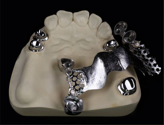 টেলিস্কোপ ধাতু মুকুট এবং সেতু দাঁত এবং Orthodontic জন্য