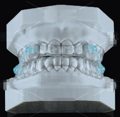 স্বচ্ছ Erkodent সিলেনসর Orthodontics Appliance Anti Snoring Mouthpiece স্বচ্ছ Erkodent সিলেনসর