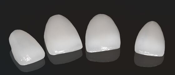 উচ্চ নান্দনিকতা কম্পোজিট ক্রাউন অনলে ভিনিয়ার কাস্টমাইজযোগ্য আকার